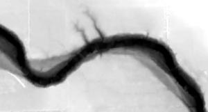 5 个免费的全球 DEM 数据源-数字高程模型 5 个免费的全球 DEM 数据源-数字高程模型